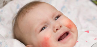 Alergia skórna u niemowląt – jak postępować? Alergia skórna u niemowląt – jak postępować?