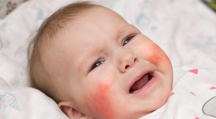 Alergia skórna u niemowląt – jak postępować?